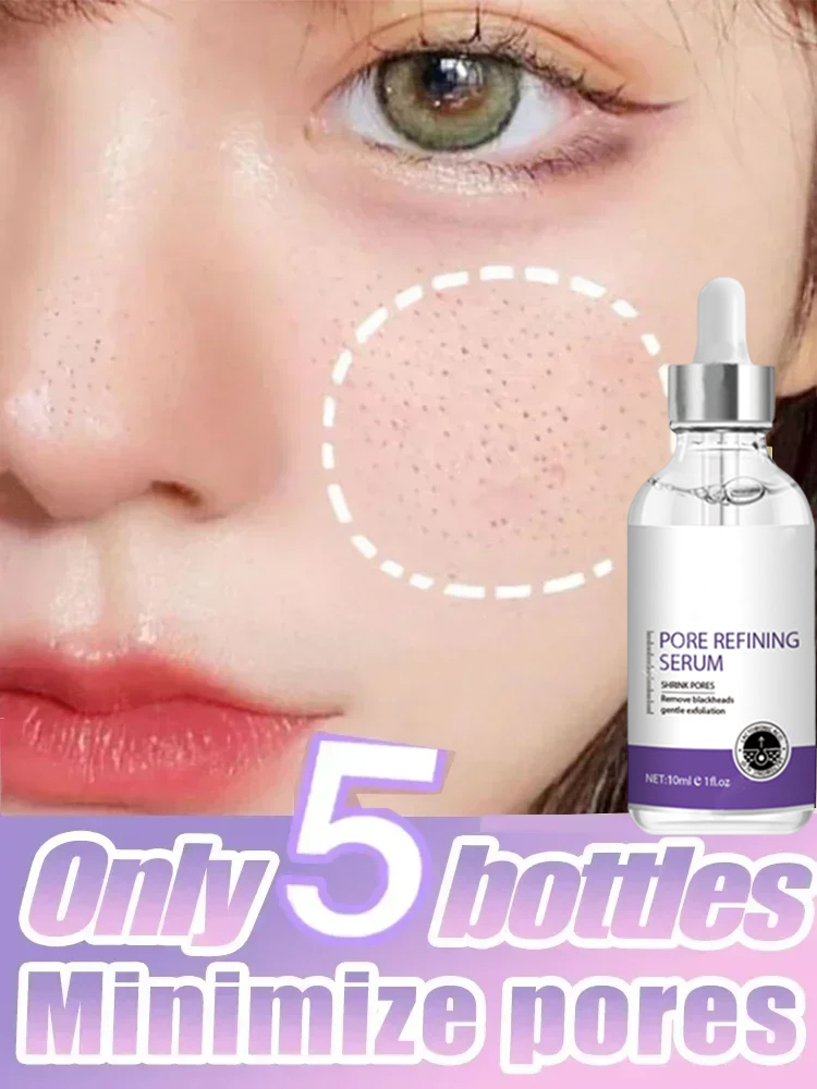 Niacinamide Brightening Serum - 3. Cilt Dokusu | Retinol ve