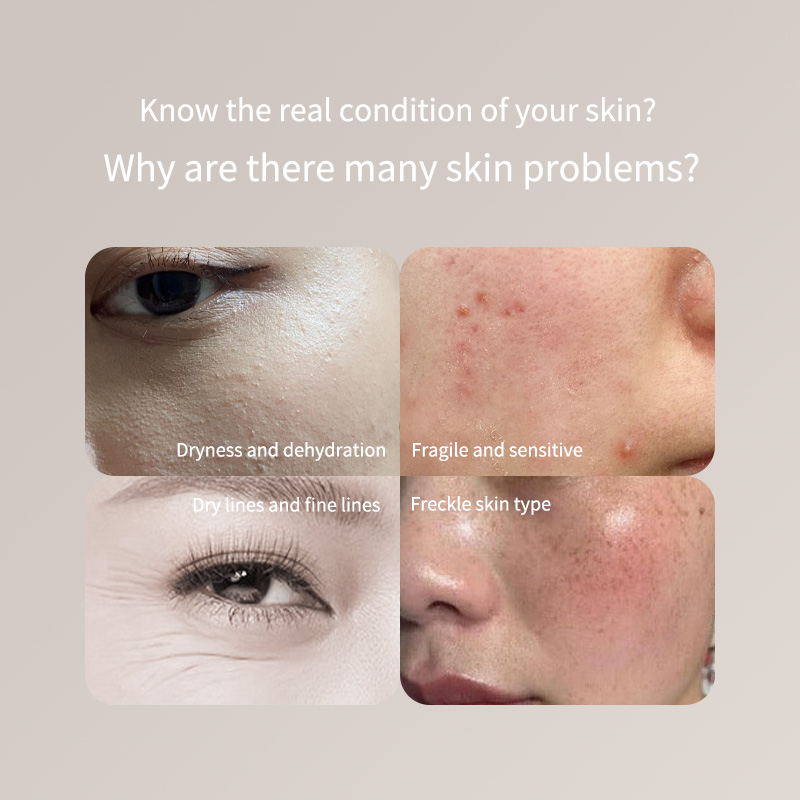 Skincare Only You - Taşınabilir Cilt Test Cihazı Kalemi -
