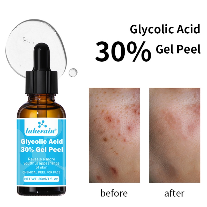 Lactic Acid Toner - 30% Glikolik Asit Peel Jel Profesyonel