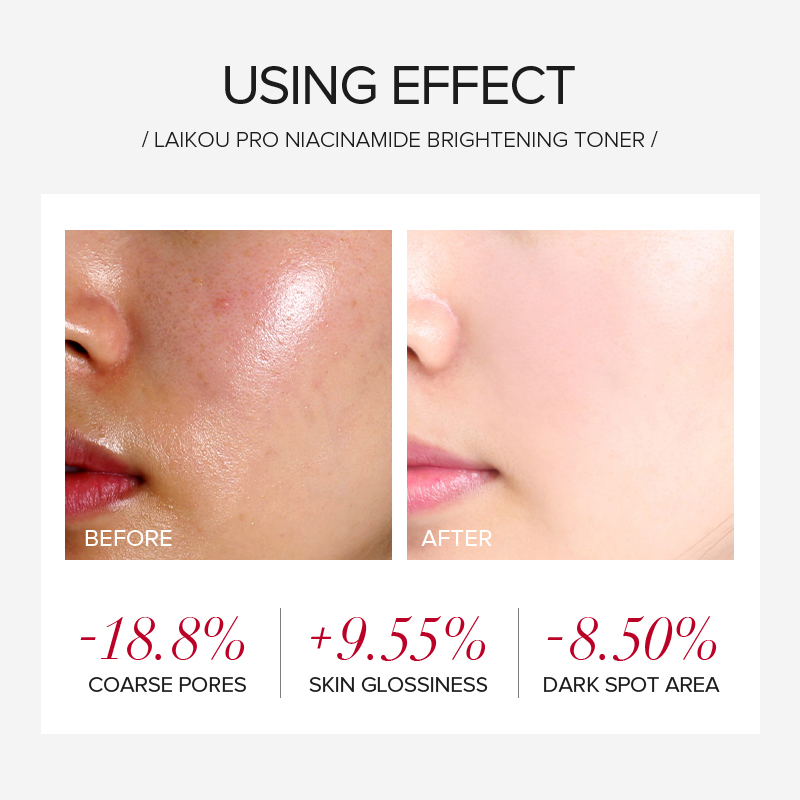 LAIKOU PRO Niacinamide 4 Parça - Niacinamide Brightening Serum incelemesi ve fiyatı