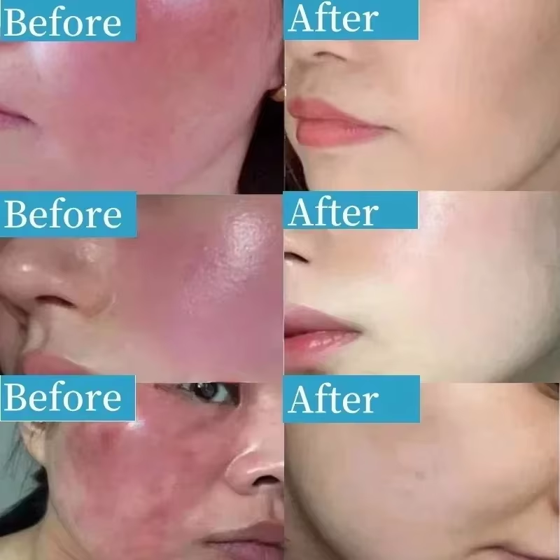 Kore Yüz Kızarıklığı Onarıcı K - Coenzyme Q10 Cream incelemesi ve fiyatı