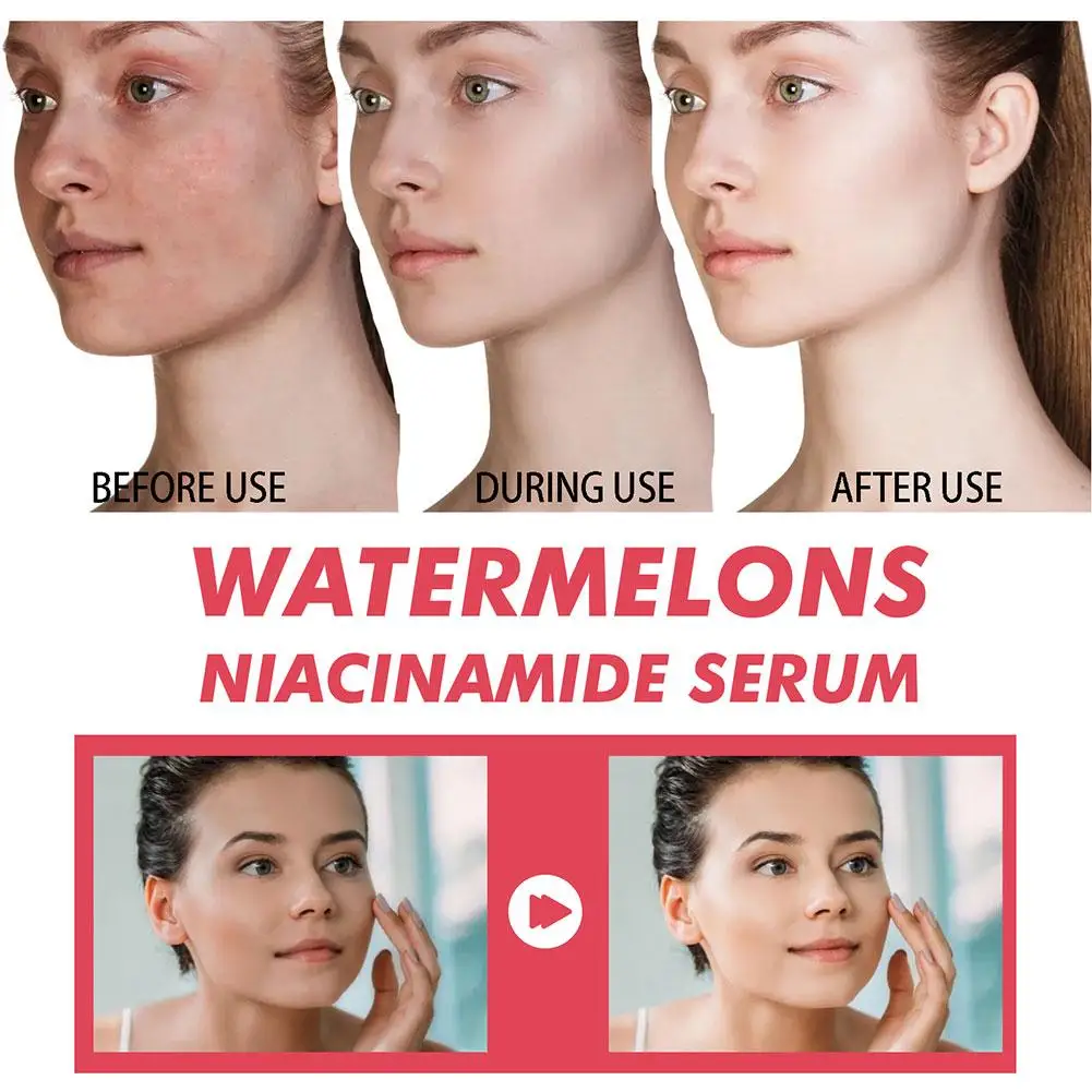 Karpuz Glow Niasinamid Nemlend - Niacinamide Brightening Serum incelemesi ve fiyatı