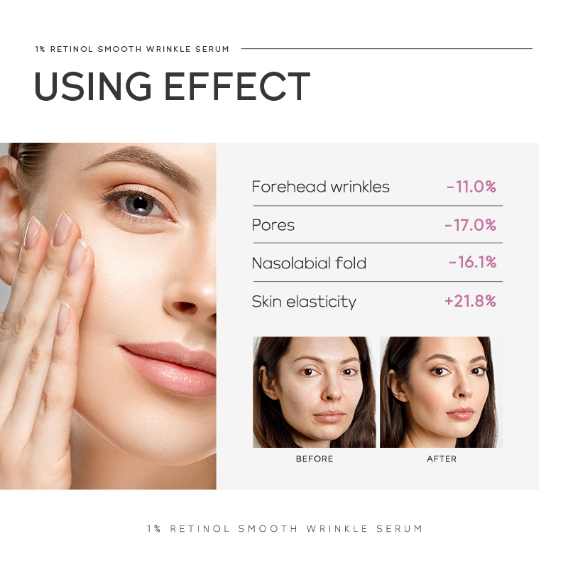 Quiyum %1 Retinol Pürüzsüzleşt - Niacinamide Brightening Serum incelemesi ve fiyatı